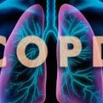 (COPD)