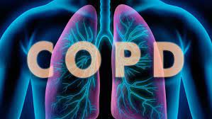 (COPD)